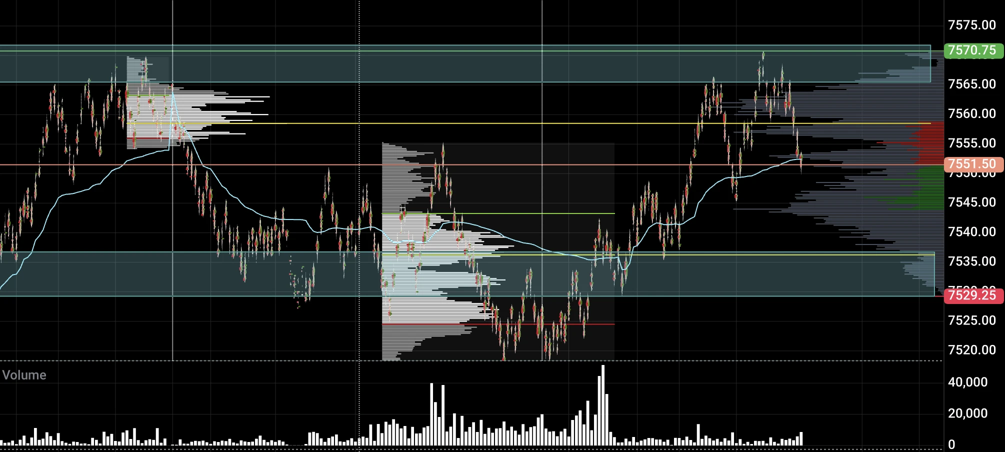 Higher timeframe chart with prior session value levels and the day's opening position marked.