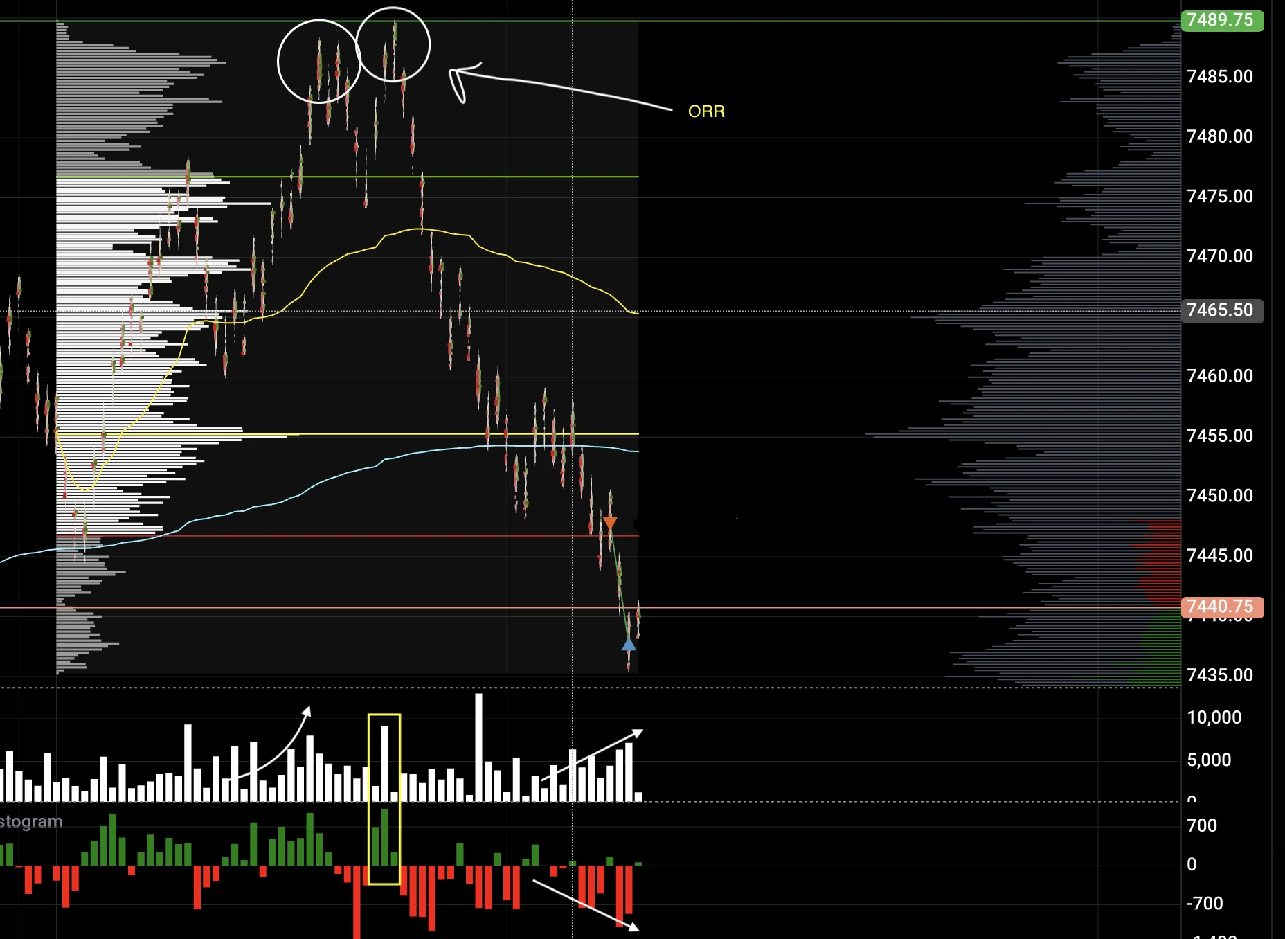 Opening rejection-reverse day annotated to show where the reversal setup develops.
